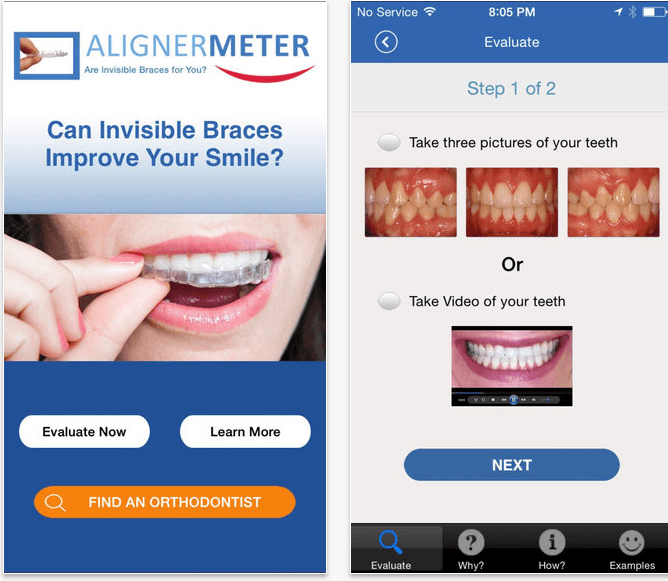 AlignerMeter! By Great Smiles LLC