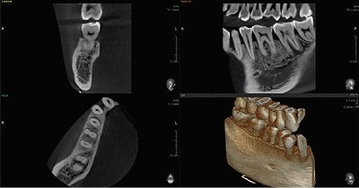 Digital Xrays